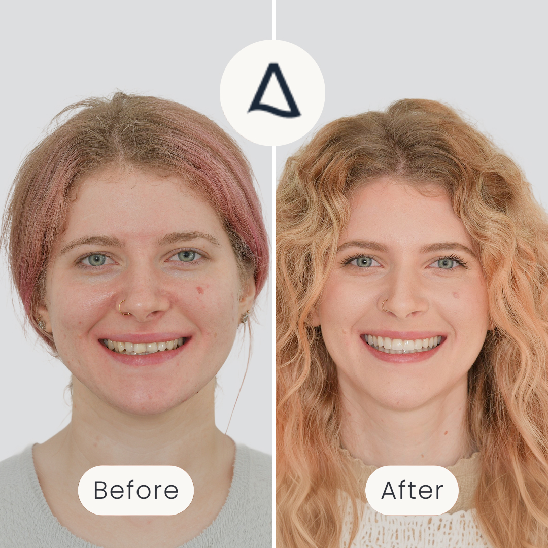 Ellen-4