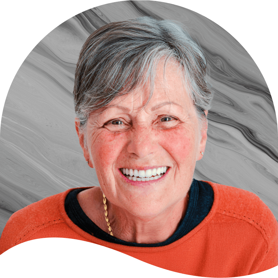 All-On-4 dental implants placement illustration