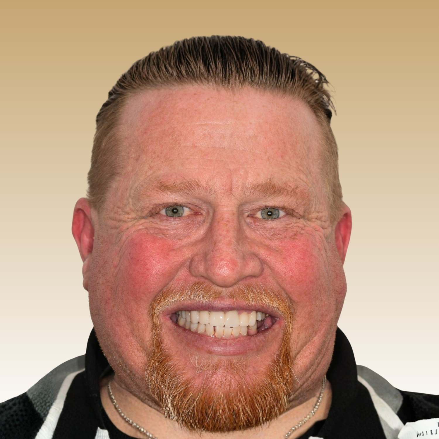 17-1