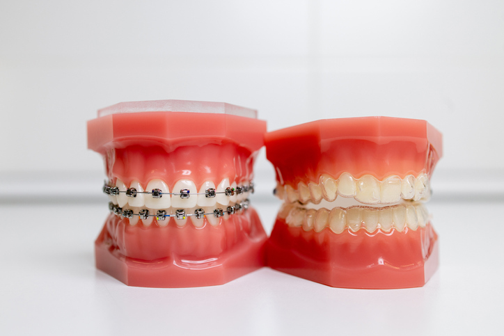 iStock-1355620313