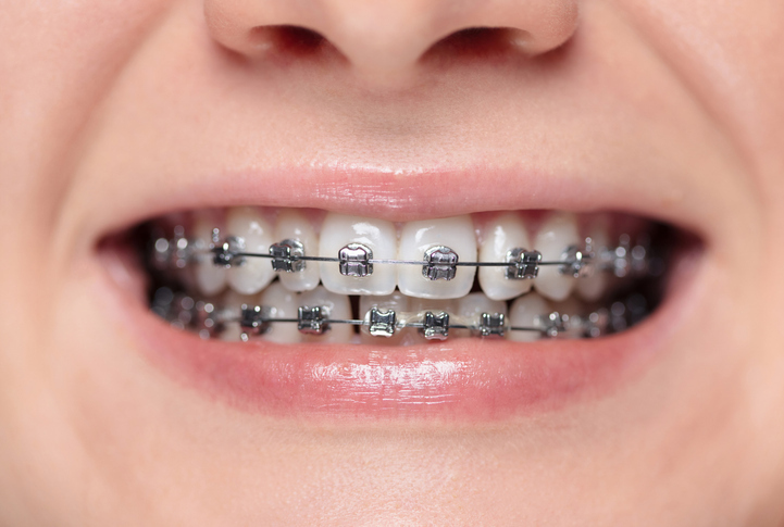 iStock-2197822151